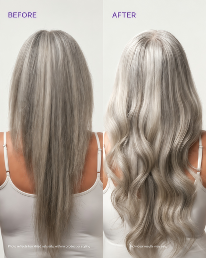 Dr. Groot Hair Thickening Conditioner For Hair loss, Thinning Hair, Korean Hair Care, Biotin Scalp Treatment, Clinically Tested, Thicker Hair, Reduces Oil
